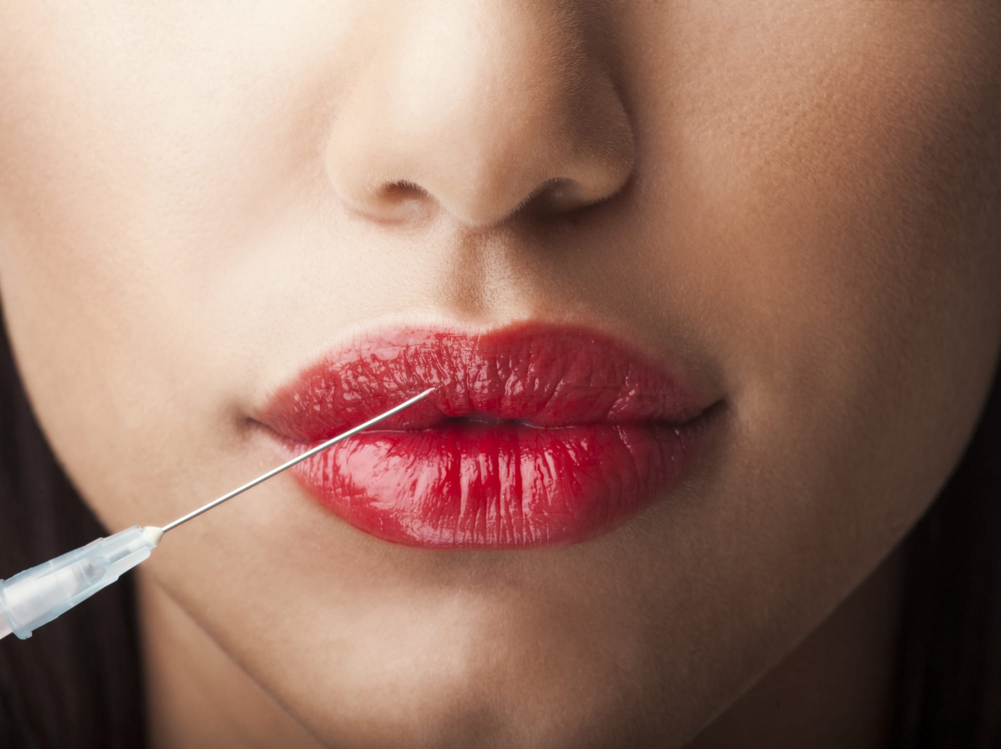 Toxina botulínica: principais usos na odontologia estética Toxina botulínica: principais usos na odontologia estética